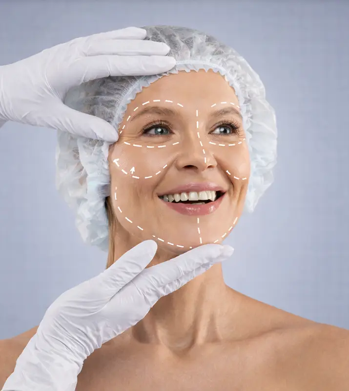 ritidectomia lifting facial vertical