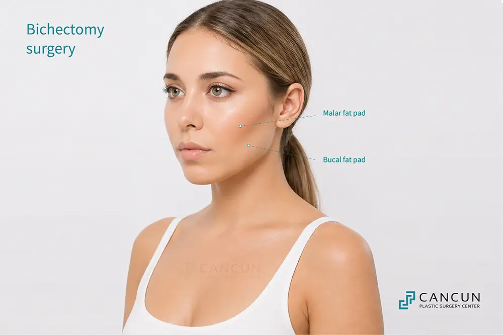 Anatomical location of the malar fat pad and buccal fat pad in the female face to understand areas treated in cosmetic facial buccal fat removal.